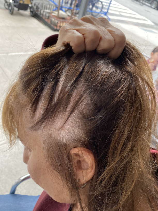 Minneapolis, Minnesota Lice Treatment & Lice Removal Service LiceDoctors